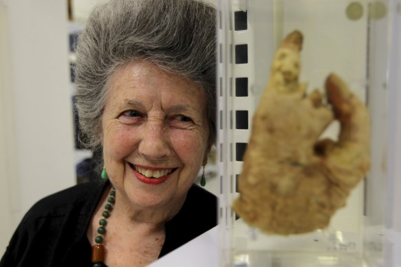 Elinor Wrobel next to a preserved hand as curator of the Lucy Osburn-Nightingale Museum at Sydney Hospital. 