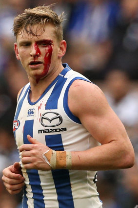 A bloodied Jack Ziebell.