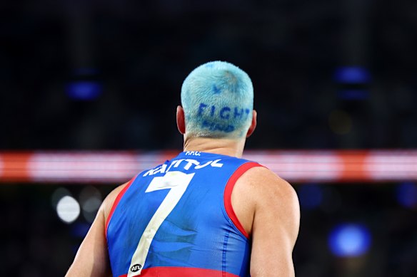 Rory Lobb dyed his hair blue for Fight MND.