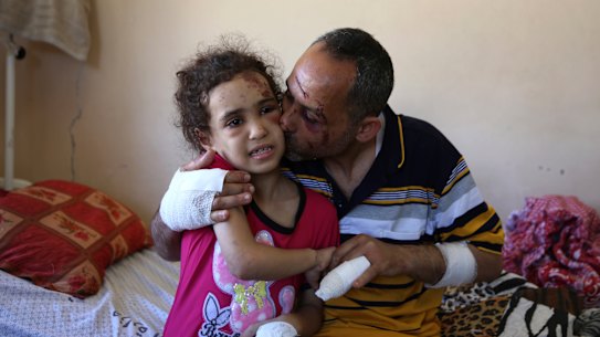 Suzy Ishkontana, 7, is kissed by her father Riad Ishkontana, 42, at Shifa Hospital in Gaza City.