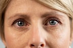 Stock image of the top half of a woman’s face