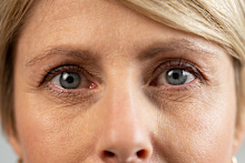 Stock image of the top half of a woman’s face