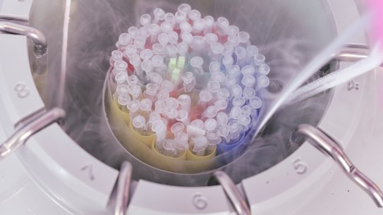 Egg freezing at Number One Fertility clinic in Melbourne.