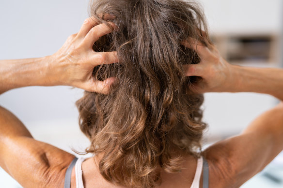 Hormonal changes are believed to contribute to changes in hair growth and scalp texture.