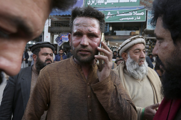An injured victim of a suicide bombing talks on his mobile phone after getting initial treatment outside a hospital in Peshawar, Pakistan.