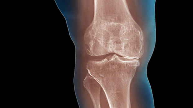 GPs have issued a warning about waste of money on useless treatments for knee pain. 