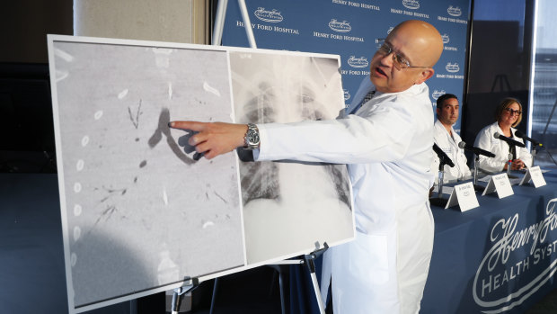 Dr Hassan Nemeh shows areas of a patient's lungs at Henry Ford Hospital in Detroit, US, after a double lung transplant for a patient whose lungs were irreparably damaged from vaping.