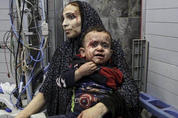 Wounded Palestinians, many of whom are women and children, wait for treatment at the al-Shifa hospital, in Gaza City.