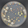 How scientists got wind of airborne germs at 3km altitude