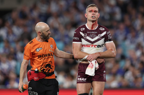 Tom Trbojevic leaves the field.
