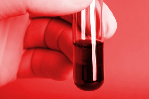 Theranos’s (ultimately unrealised) goal was to develop a miniature robotic lab that could run hundreds of diagnostic tests from just a small drop of patients’ blood that could be used in drugstores and doctors’ offices.