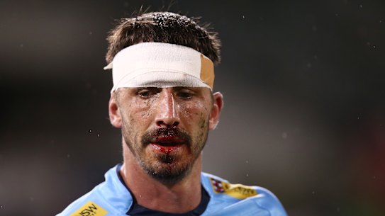 Jake Gordon looking worse for wear.