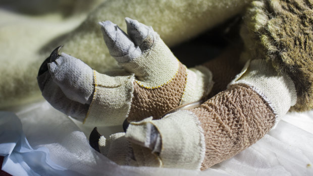 Princess Fiona's burned feet are wrapped in layers of bandages and dressings. 