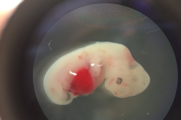 In 2017, scientists grew a human-pig chimera embryo and took it a third of the way through pregnancy.