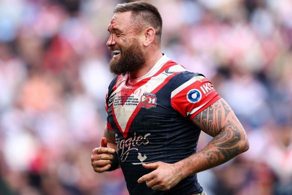 Sydney Roosters’ forward Jared Waerea-Hargreaves laughs as he leaves the field with head cut.