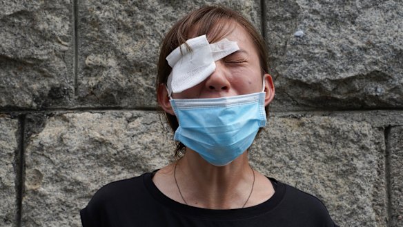 A medical student cries as she wears an eye patch to show solidarity with a woman injured by a police projectile during a previous protest.