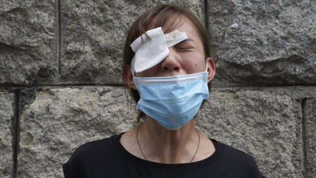 A medical student cries as she wears an eye patch to show solidarity with a woman injured by a police projectile during a previous protest.