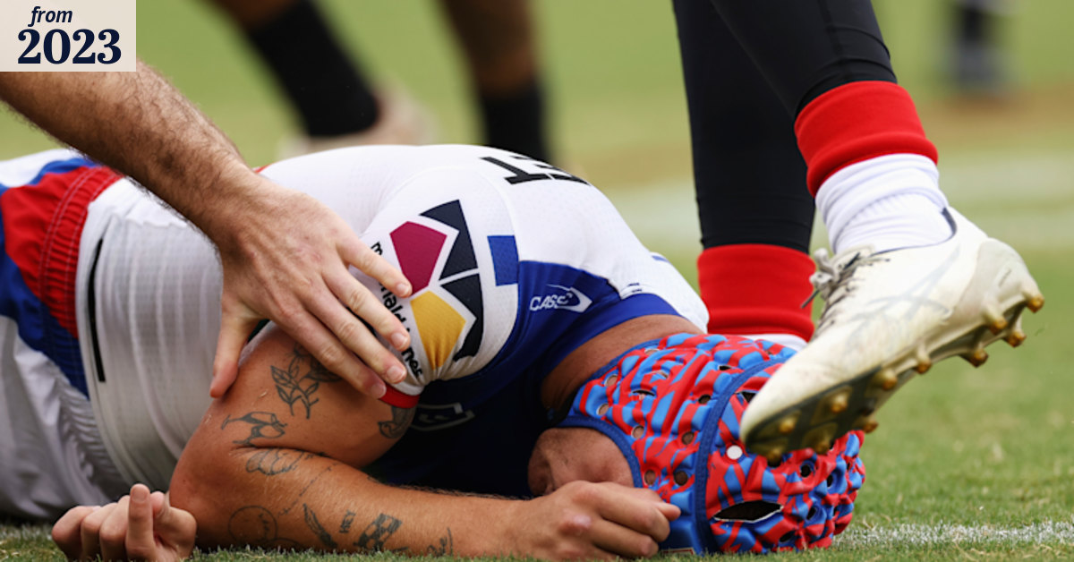NRL move on concussion long overdue