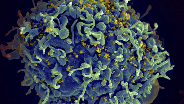 This electron microscope image shows a human T cell, in blue.