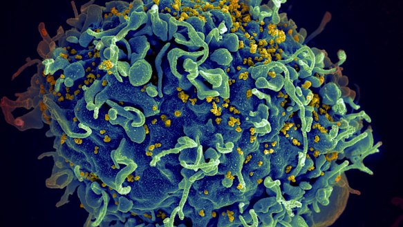 This electron microscope image shows a human T cell, in blue.