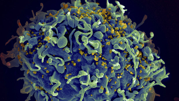 This electron microscope image shows a human T cell, in blue, under attack by HIV, in yellow.