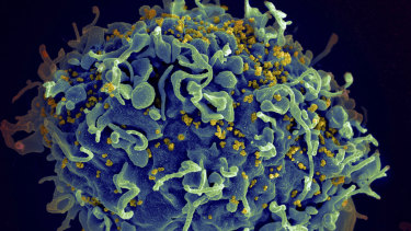 This electron microscope image shows a human T cell, in blue, under attack by HIV, in yellow.