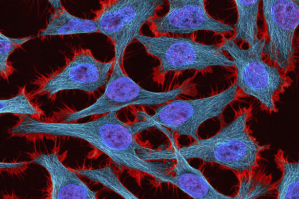 HeLa cells were the first-ever cell line established outside the body and have underpinned countless medical discoveries since 1951.