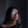 Former Greens candidate Hannah Thomas is recovering from an eye injury suffered after police broke up a protest in Sydney last month