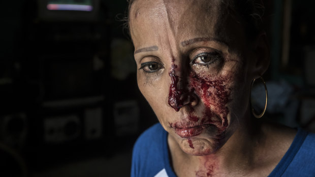 A woman with her face bloodied after she was pummeled by the police, stands in shock inside a house after a peaceful anti-government march was dissolved violently by government forces, in Managua, Nicaragua.