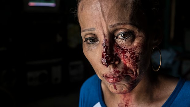 A woman with her face bloodied after she was pummeled by the police, stands in shock inside a house after a peaceful anti-government march was dissolved violently by government forces, in Managua, Nicaragua.