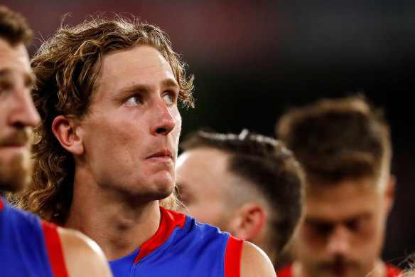 Western Bulldogs forward Aaron Naughton suffered a corked calf last week against Carlton.