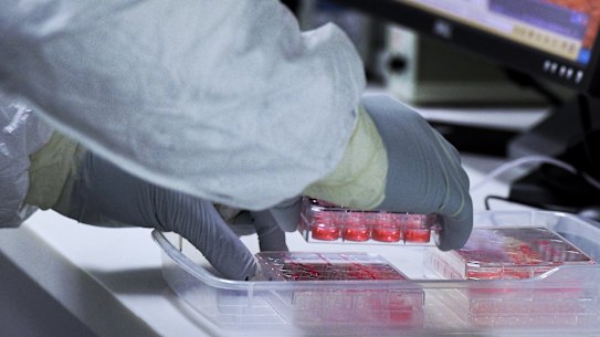 The Omicron variant growing in cells at St Vincent’s Centre for Applied Medical Research in Sydney.