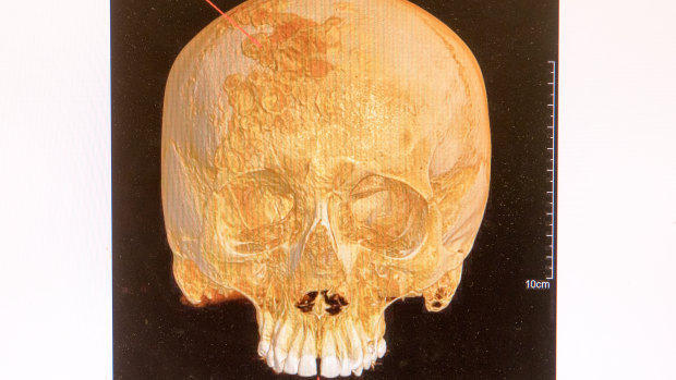 The skull found at Sandy Point.