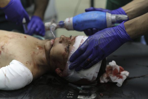 A wounded Palestinian child receives medical treatment at the Nasser Hospital following Israeli bombardment on Khan Younis refugee camp, southern Gaza Strip,  on Monday.