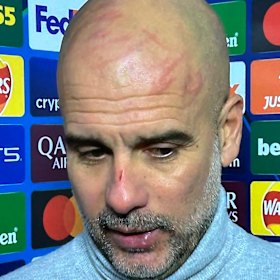 Pep Guardiola’s scratched face said it all last season.
