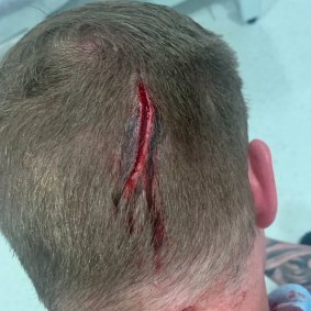 A NSW Police probationary constable suffered a head wound during the incident in Gladesville. 