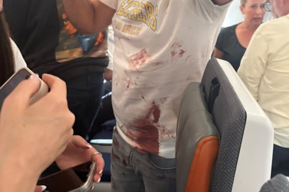 Una foto che mostra presumibilmente uno dei passeggeri del flydubai FZ1073 con il sangue sulla maglietta.
