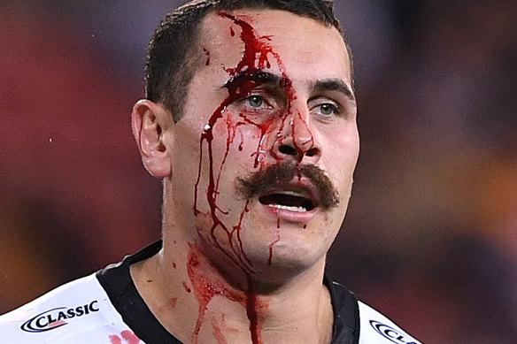 Bloody mess: Reagan Campbell-Gillard feels the pain against the Tigers.