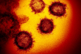 A microscope image from the US National Institutes of Health shows the Novel Coronavirus SARS-CoV-2, also known as 2019-nCoV, the virus that causes COVID-19.