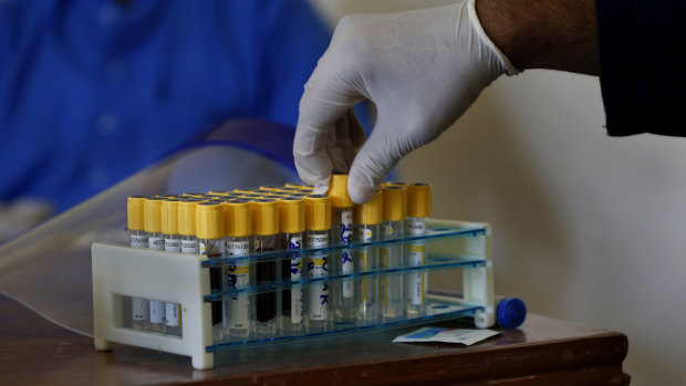 A health worker adjusts samples during door-to-door testing for coronavirus in Islamabad, Pakistan.
