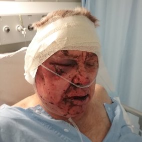 Mike Wilson recovering in hospital following the alleged attack.
