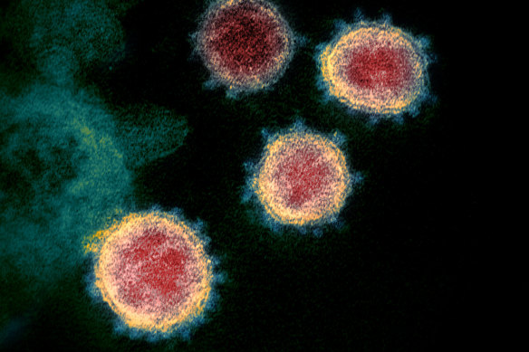 The coronavirus that causes COVID-19. 