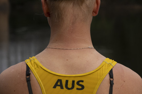 A scar from brain surgery is still visible on the back of Mitchell’s neck. 