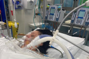 Marie in ICU at St Vincent’s Hospital hours after a cosmetic surgery procedure. 
