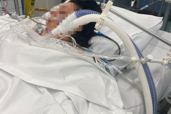 Marie in ICU at St Vincent’s Hospital hours after a cosmetic surgery procedure. 