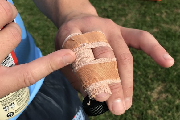 Ouch: Kotoni Staggs shows off his strapped fingers