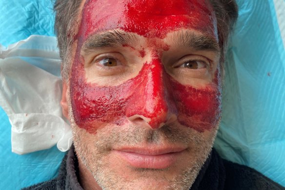 Todd Sampson undergoes a leech facial for his new series Mirror Mirror: Are You Well?
