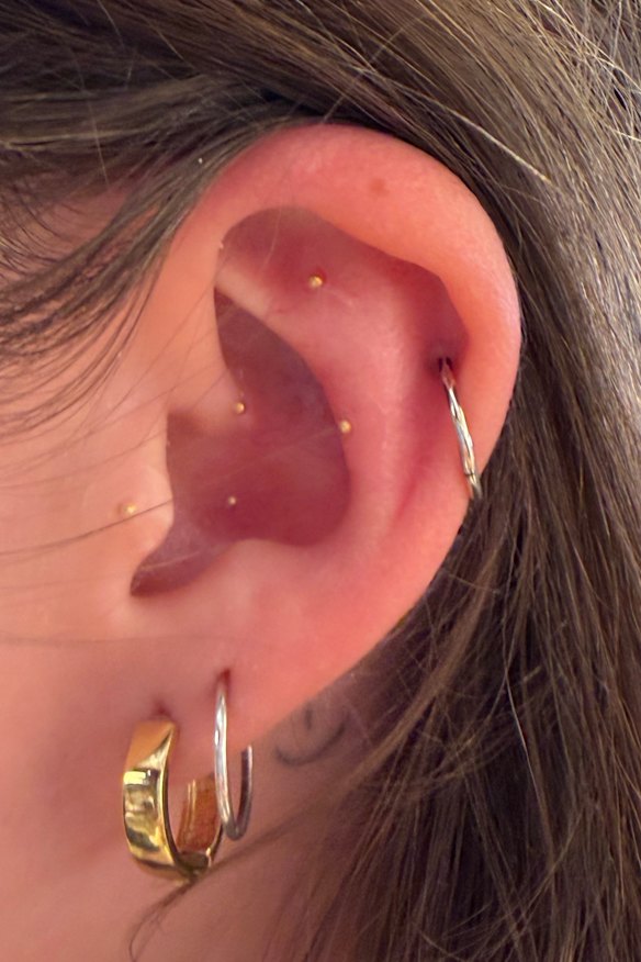 Five of my ear seeds shortly after application.