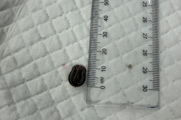 The tick that was found on Pumpkin the cat’s tail