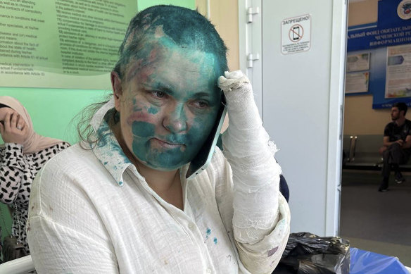 After being allegedly attacked and doused with green antiseptic, Novaya Gazeta journalist Elena Milashina received medical treatment in Grozny, Russia.